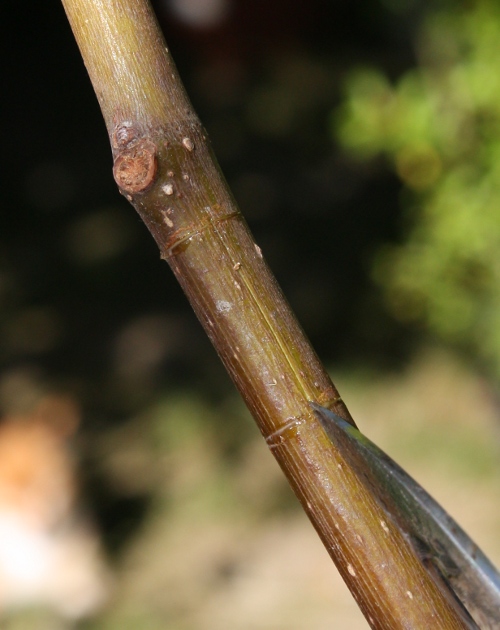 incision verticale